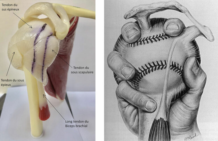 Fig. 14 Coiffe des rotateurs en vue latérale (à gauche). Modélisation du centrage actif tel un gant autour d’une balle de baseball (à droite).