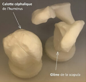 Fig. 3 Surfaces de l’articulation scapulo-humérale de l’épaule